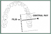 Figure 49 – Maxillary Molars