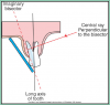 Figure 50 – Maxillary Molars