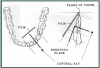 Figure 54 – Mandibular Canines