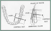 Figure 56 – Mandibular Premolars