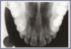 Figure 64 – Maxillary Topographical Occlusal Image