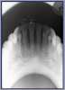 Figure 66 – Mandibular Topographical Occlusal Image