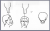 Figure 69 – Maxillary Vertex Occlusal