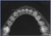 Figure 70 – Mandibular Cross-Sectional Occlusal Image