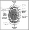 Figure 4A – Placement of Topical Anesthetic (from Ehrlich, A., Torres, H., and Bird, D.: Essentials of Dental Assisting, 2nd ed. Philadelphia, W.B. Saunders, 1996, p 281.)