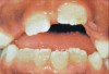 Fig. 2 Malocclusion (<a href-